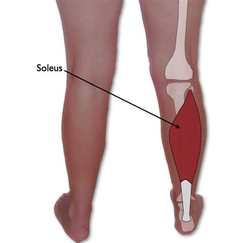 why does my soleus hurt